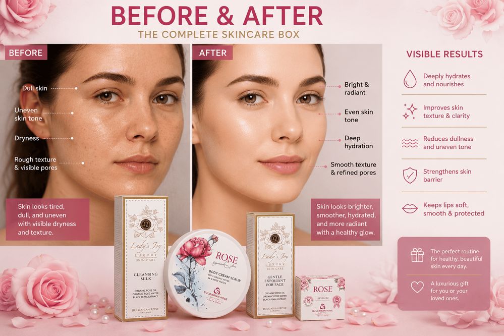 Luxury Rose Skincare Box – Glow & Care Set_thumbnail_1